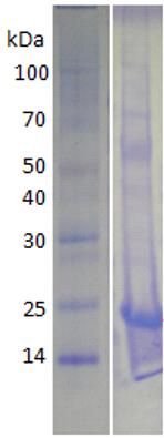 15% SDS-PAGE analysis profiles of purified KP1_3820-26-153 (CBB stained).